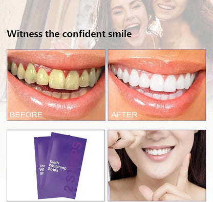 14/28 Strips Purple Teeth Whitening Kit – Remove Plaque & Stains Instant Color Corrector for Yellow Teeth Oral Hygiene Care